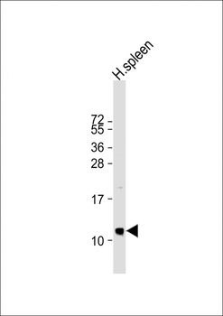 PPBP Antibody (N-term)