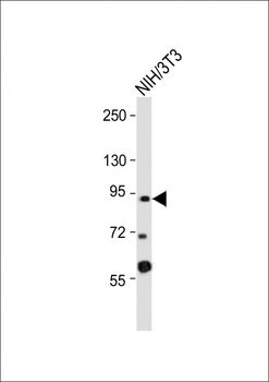 DYRK1A Antibody (Center)