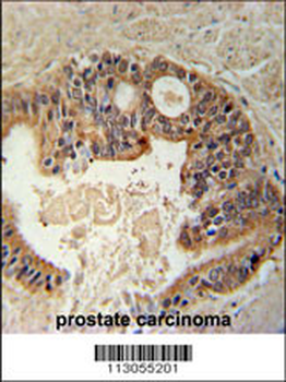 DYRK1A Antibody (N-term)