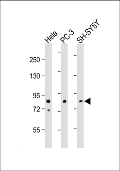 DYRK1A Antibody (N-term)