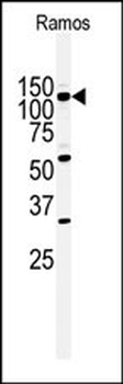 HIPK2 Antibody (Center)