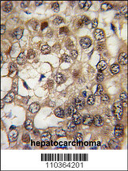 HIPK2 Antibody (Center)