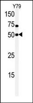 CLK1 Antibody (N-term)