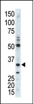 CDC2 (CDK1) Antibody (C-term)