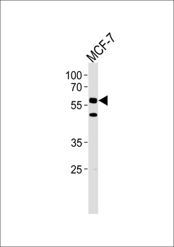 CDC7 (CDC7L1) Antibody (N-term)