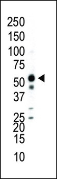 JNK2 (MAPK9) Antibody (C-term)