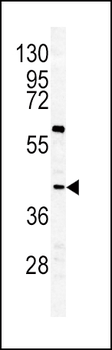 GHRHR Antibody (C-term)