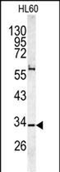CAPZA1 Antibody (N-term)