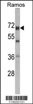 DDX5 Antibody (Center)