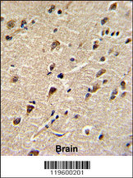 DDX5 Antibody (Center)