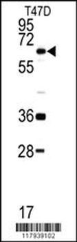 DDX5 Antibody (C-term)