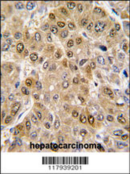 DDX5 Antibody (C-term)