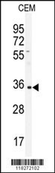 IGHA1 Antibody (C-term)