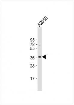 IGHA1 Antibody (C-term)