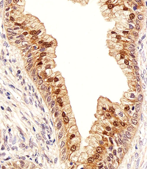 IDH1 Antibody (Center)