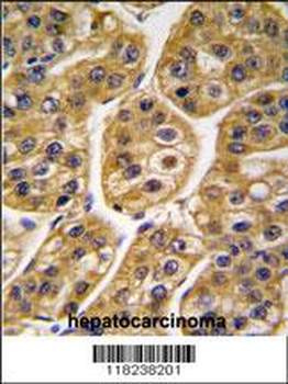 IDH1 Antibody (Center)