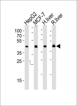 IDH1 Antibody (Center)