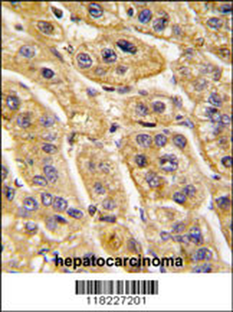 HIBCH Antibody (Center)