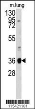 ANXA2 Antibody (N-term)
