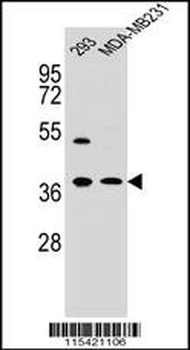 ANXA2 Antibody (N-term)