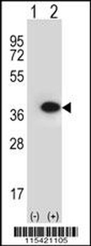 ANXA2 Antibody (N-term)
