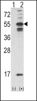 CAMK2A Antibody (C-term E370)