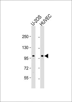GIT1-Y554 Antibody (C-term)