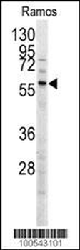 MEN1 Antibody (T594)