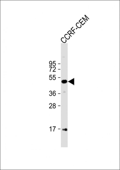 MYCN Antibody (C-term)