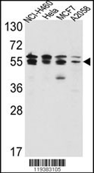 IMPDH2 Antibody (Center)