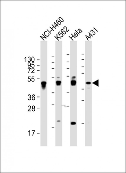 CYK18 Antibody (C-term)