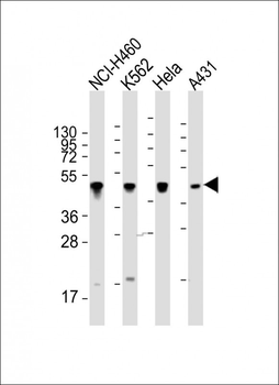 CYK18 Antibody (C-term)