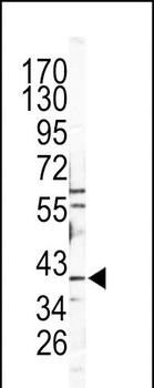 CATB Antibody (Center)