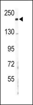COL5A2 Antibody (N-term)