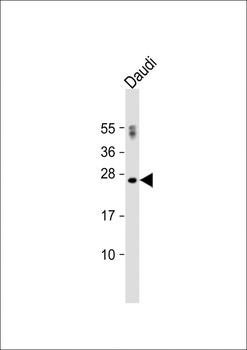 PTTG1 Antibody (N-term)
