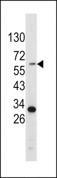 Tyrosinase Antibody (C-term)