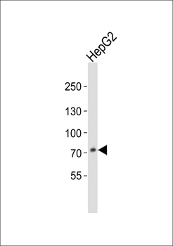 PCSK9 Antibody (C-term)
