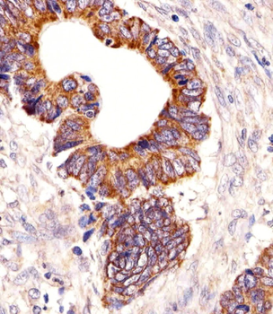PCSK9 Antibody (N-term)