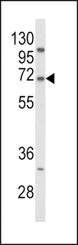 PCSK9 Antibody (N-term)