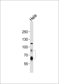 PCSK9 Antibody (N-term)