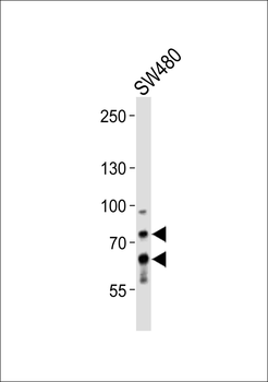 PCSK9 Antibody (N-term)
