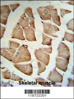 GSN Antibody (C-term)