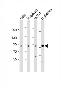 GSN Antibody (C-term)
