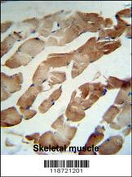 GSN Antibody (N-term)