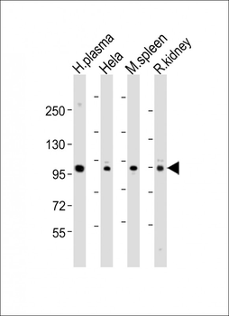GSN Antibody (N-term)