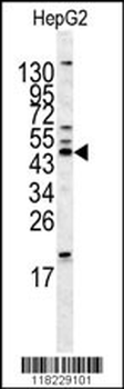 HOMER1 Antibody (N-term)
