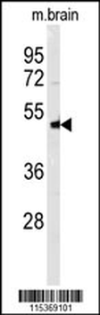 NPTX1-Y344 Antibody