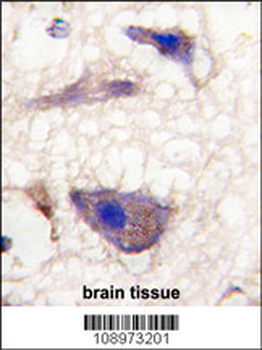 NP1(Nptx1) Antibody (C-term)