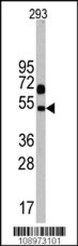 NP1(Nptx1) Antibody (C-term)