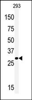 MOX1 (Meox1) Antibody (N-term)